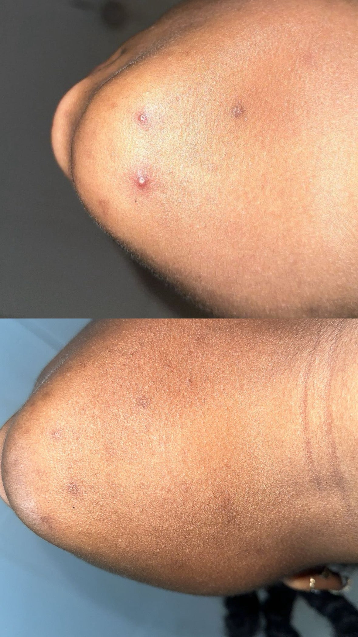 Clear Me Raspberry-Matcha Cleanser