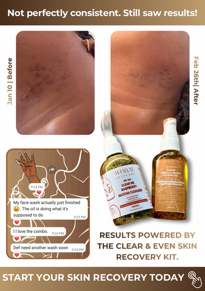 Clear & Even Skin Recovery Kit